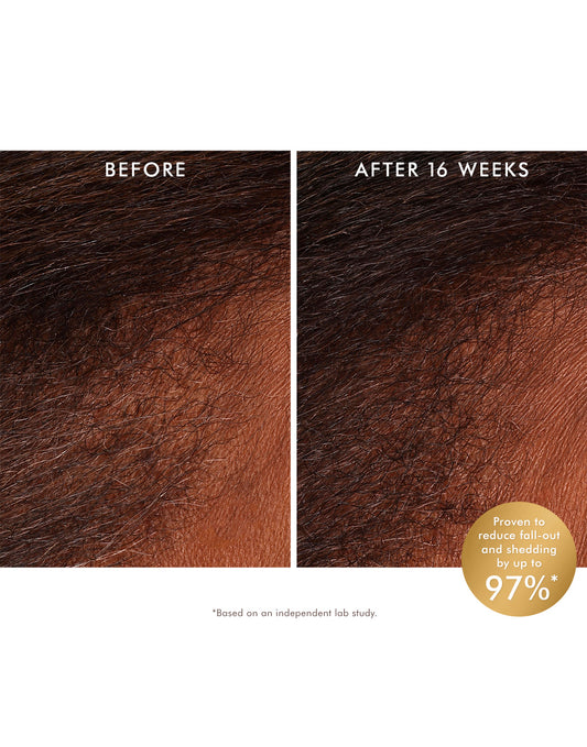 Nước Hoa Hồng Cân Bằng Da Đầu Revitalizing Scalp Tonic