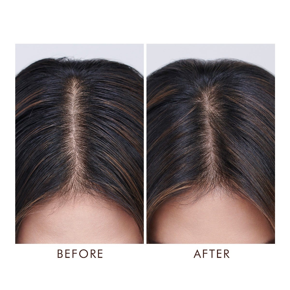 Dung Dịch Trị Liệu Da Đầu Dư Dầu Oily Scalp Treatment